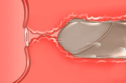 Page 202 of NTR-CUCKOLD CLUB