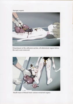 Page 8 of Nishiogikubo Shoujo Satsugai Jiken Shihou Kaibou Kiroku | Nishi-Ogikubo Girl Murder Case Judicial Autopsy Report