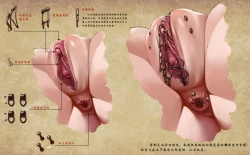 Page 4 of D vs N Ch. 2