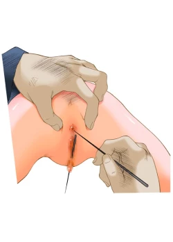 Page 35 of S-DOG Choubatsu Hari no Batsu