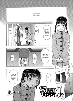 Page 3 of Scar Tissue