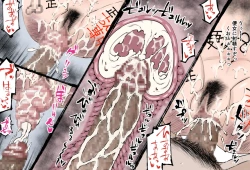 Page 34 of Uterine degeneracy after