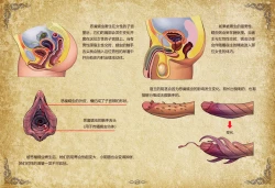 Page 176 of D VS N CH 1-7